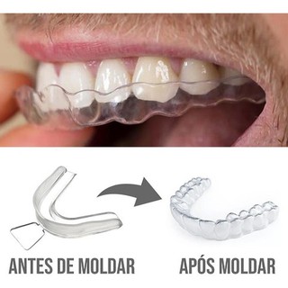 Kit dental 1 par de moldeira + Estojo + 3 Seringas Gel Clareamento Dental 44% (2)