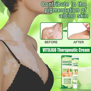 Creme Ingredient Vivigo Cuidados Seguro De Usar Com A Pele Pigmentação/Regulação Corporal Hidratante (1)