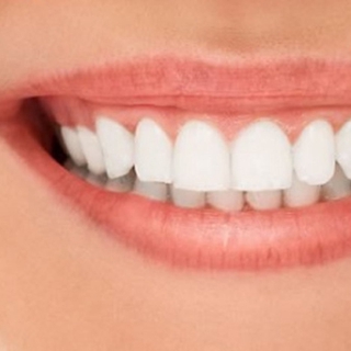 Upper Row De Dentes Brancos Definir Simulação Na Linha De Silicone De Prótese Set Folheados Flex Dentadura (6)