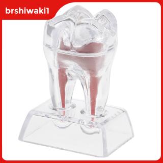 Base De Cristal Dentista Modelo De Molar Dente De Plástico Rígido Estudo De Estudo (3)