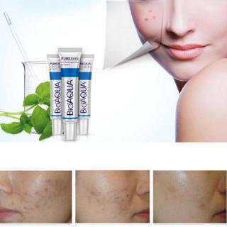 Facial Bioaqua Creme 30g Cuirdado Facial Clareador Creme Redutor De Poros Abertos Cuirado Facial (4)