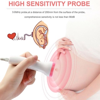 Fetal Doppler Detector Baby Heart Rate Prenatal Monitor Ultrasound Fetal Heart Rate Monitor (3)