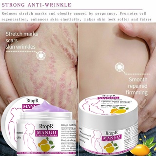 Stretch Marks And Scar Removal Stretch Marks Maternity Skin Body Repair Cream Remove Skin Care Products (1)