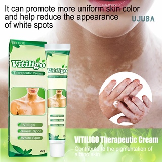 Ujuba 20g White Tag Cream Unique Easy to Use Plant Extracts Vitiligo Therapeutic Cream for Ladies