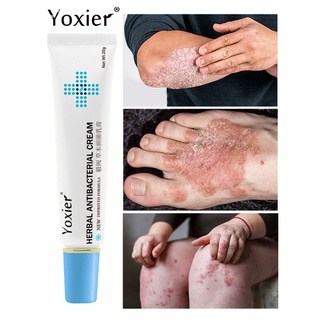 Yoxier Creme Herbal Antibacteriano Para Alívio Da Pele De Eczema / Urticaria / Desquamação 20g Yoxier Creme Herbal
