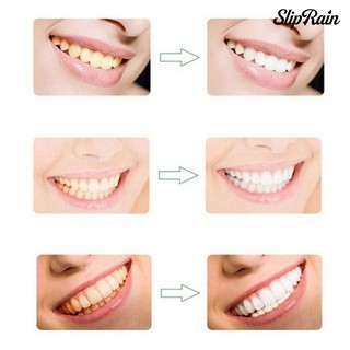 Removedor De Manchas De Dentes Branqueadora Natural / Cuidado Oral / Higiene Bucal (8)