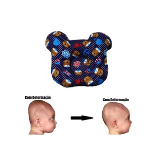 Travesseiro que evita cabeça chata em bebes (cabeça amassada) Evita e Corrige travesseiro Modelador