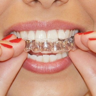 1 Par de Moldeira Para Clareamento Dental Ranger de dentes