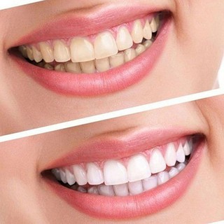 Pó Carvão Ativado Clareador Dentes Teeth Whitening 30g (2)