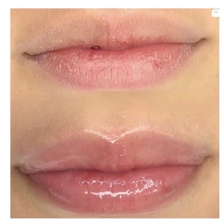 Gloss Lip Volumoso com Ácido Hialurônico Cor 06 Max Love (3)