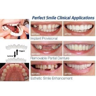 1Par Dentadura Confortável Reutilizável p/ Dente Branco Perfeito (8)