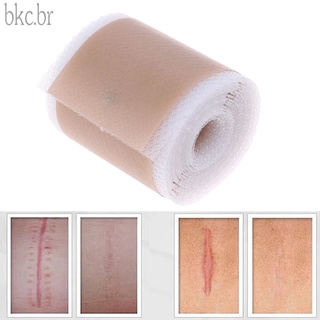 Efficient Beauty Scar Removal Silicone Gel Self-Adhesive Silicone Gel Tape Patch for Acne Burn Scar Reduce (1)