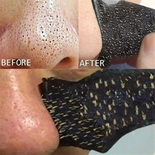 10 Peça/Adesivo Removedor De Cravos Bambu-Mascara Facial-Purificante-Skin Caremáscara Removedora De Cravos (1)