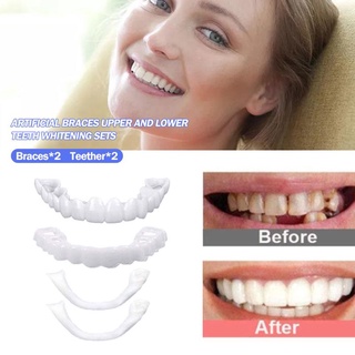 Chaves De Dentadura Silicone Superior E Inferior Dentes Falsos Clareamento Dental Sorriso Folheados Dentista Ferramentas Cosméticos Falso Dente