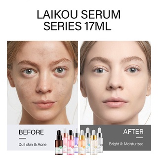 [Promoção] LAIKOU Serum Facial Vitamin C/Sakura/24K Gold Snail/Essência Hialurônico Para Remoção De Poros E Acne Clareador AntirrugasBrightening Soothing Skin (5)