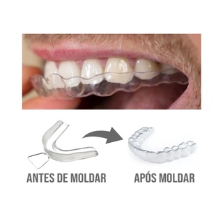 Placa Anti Bruxismo ( Protetor Dental Moldável ) + Estojo (1)