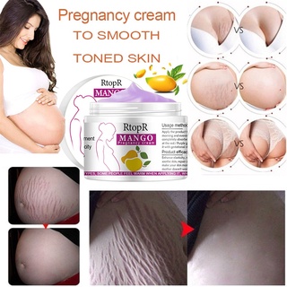 Stretch Marks And Scar Removal Stretch Marks Maternity Skin Body Repair Cream Remove Skin Care Products (2)