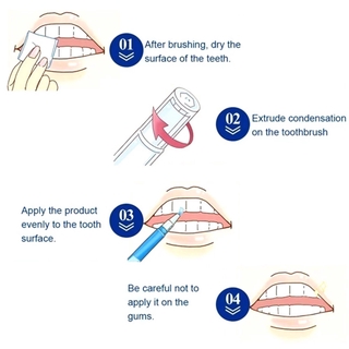 Caneta Clareadora Para Os Dentes Branqueadora/Removedor De Manchas/Dental Clareador/Higiene Bucal/Branco LKZ (6)