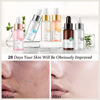 [Promoção] LAIKOU Serum Facial Vitamin C/Sakura/24K Gold Snail/Essência Hialurônico Para Remoção De Poros E Acne Clareador AntirrugasBrightening Soothing Skin (3)