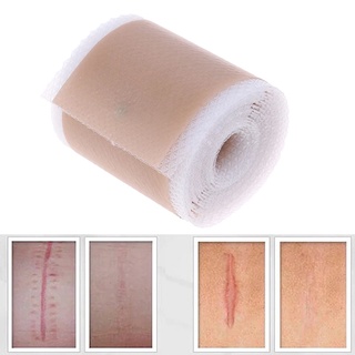 Efficient Beauty Scar Removal Silicone Gel Self-Adhesive Silicone Gel Tape Patch for Acne Burn Scar Reduce (2)