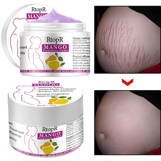 Stretch Marks And Scar Removal Stretch Marks Maternity Skin Body Repair Cream Remove Skin Care Products (5)
