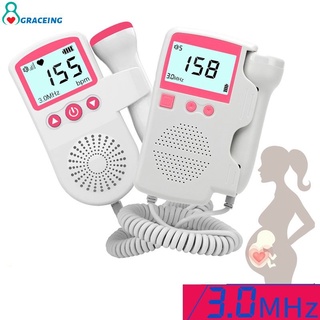 Display LCD Sem Radiação Fetal Doppler Monitor De Freqüência Cardíaca Para Casa Bebê Som gravidez bebê som fetal detector Graça