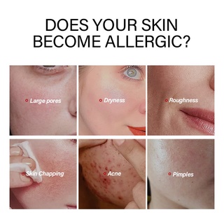 [Promoção] LAIKOU Serum Facial Vitamin C/Sakura/24K Gold Snail/Essência Hialurônico Para Remoção De Poros E Acne Clareador AntirrugasBrightening Soothing Skin (2)